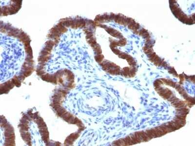 Immunohistochemistry-Paraffin: ASRGL1 Antibody (CRASH/1289) - Azide and BSA Free [NBP2-54450]