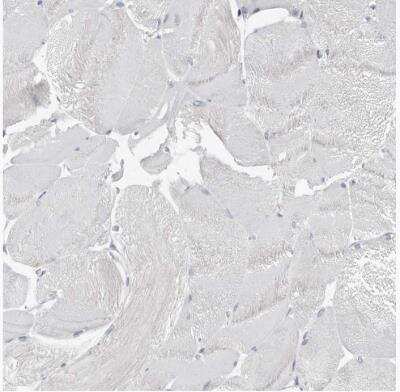 Immunohistochemistry-Paraffin: ASRGL1 Antibody [NBP1-89133]