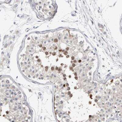 Immunohistochemistry-Paraffin: ASRGL1 Antibody [NBP1-89133]