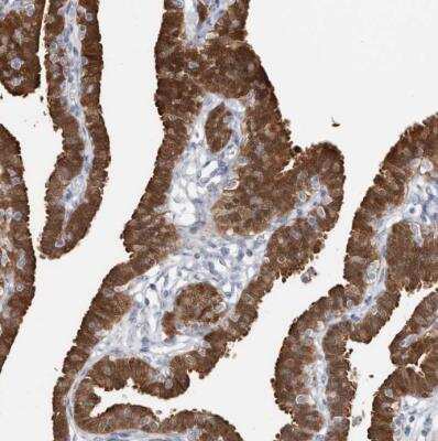 Immunohistochemistry-Paraffin: ASRGL1 Antibody [NBP1-89133]