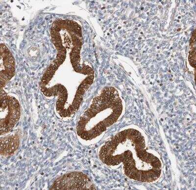 Immunohistochemistry-Paraffin: ASRGL1 Antibody [NBP1-89133]