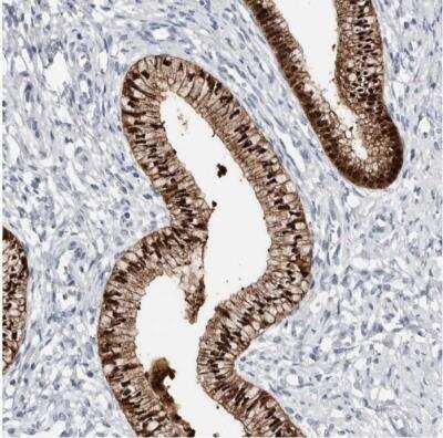 Immunohistochemistry-Paraffin: ASRGL1 Antibody [NBP1-89133]
