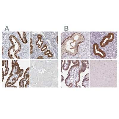Immunohistochemistry-Paraffin: ASRGL1 Antibody [NBP1-89133]