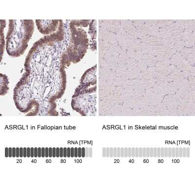 Immunohistochemistry-Paraffin: ASRGL1 Antibody [NBP2-38759]