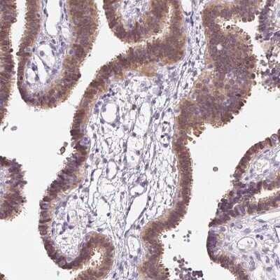 Immunohistochemistry-Paraffin: ASRGL1 Antibody [NBP2-38759]