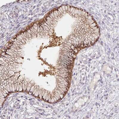 Immunohistochemistry-Paraffin: ASRGL1 Antibody [NBP2-38759]