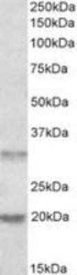 Western Blot: ASRGL1 Antibody [NBP1-00155]