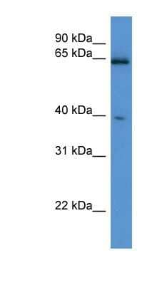 Western Blot: ASRGL1 Antibody [NBP1-79544]