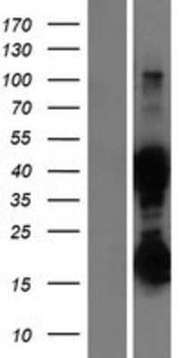 Western Blot: ASRGL1 Overexpression Lysate [NBP2-06243]