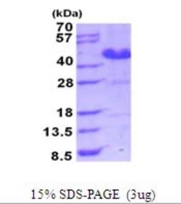 SDS-PAGE: Recombinant Human ASRGL1 His Protein [NBP2-51898]