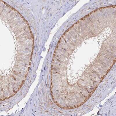 Immunohistochemistry-Paraffin: ASTE1 Antibody [NBP1-81661]