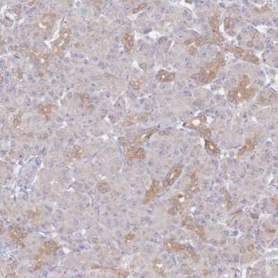 Immunohistochemistry-Paraffin: ASTE1 Antibody [NBP1-81661]