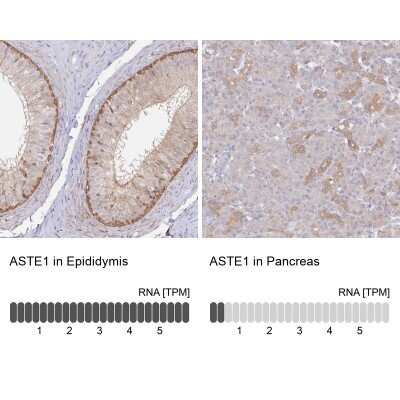 Immunohistochemistry-Paraffin: ASTE1 Antibody [NBP1-81661]