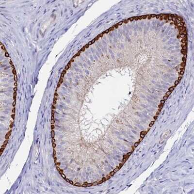 Immunohistochemistry-Paraffin: ASTE1 Antibody [NBP1-81662]