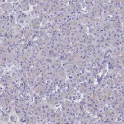 Immunohistochemistry-Paraffin: ASTE1 Antibody [NBP1-81662]