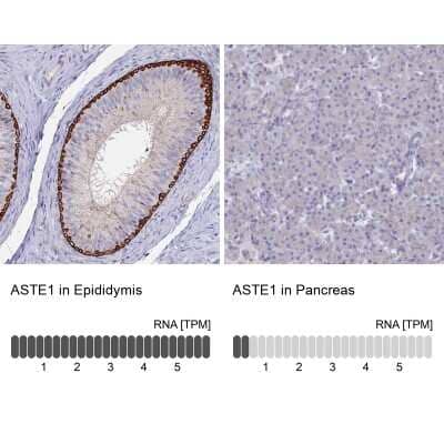 Immunohistochemistry-Paraffin: ASTE1 Antibody [NBP1-81662]