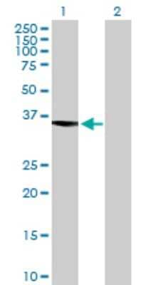 Western Blot: ASTE1 Antibody [H00028990-B01P]