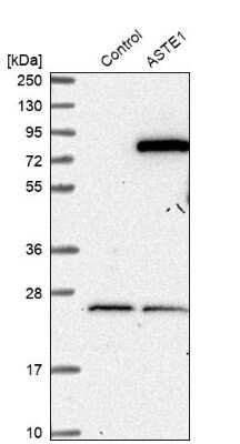 Western Blot: ASTE1 Antibody [NBP1-81661]