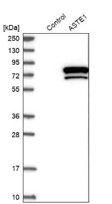 Western Blot: ASTE1 Antibody [NBP1-81662]