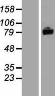 Western Blot: ASTE1 Overexpression Lysate [NBP2-07382]