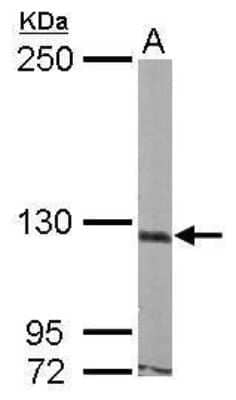 Western Blot: ASTN1 Antibody [NBP2-43576]