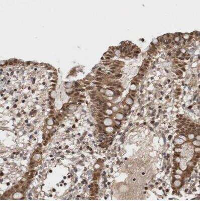Immunohistochemistry-Paraffin: ASTN2 Antibody [NBP1-82980]