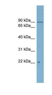 Western Blot: ASUN Antibody [NBP1-70427]