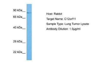 Western Blot: ASUN Antibody [NBP2-84473]