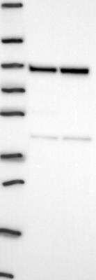 Western Blot: ASUN Antibody [NBP3-17344]