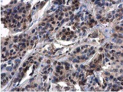Immunohistochemistry-Paraffin: ASXL1 Antibody [NBP2-43807]
