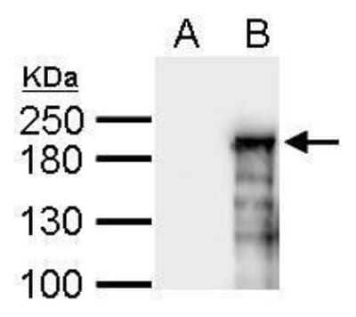 Western Blot: ASXL1 Antibody [NBP2-43807]