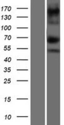 Western Blot: ASXL1 Overexpression Lysate [NBP2-07185]