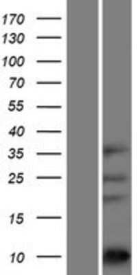 Western Blot: ASXL1 Overexpression Lysate [NBP2-10136]