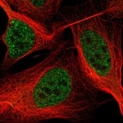 Immunocytochemistry/ Immunofluorescence: ASXL2 Antibody [NBP2-56782]