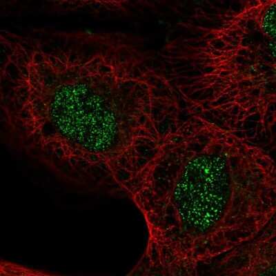 Immunocytochemistry/ Immunofluorescence: ASXL2 Antibody [NBP2-58342]