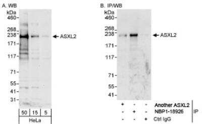 Western Blot: ASXL2 Antibody [NBP1-18926]