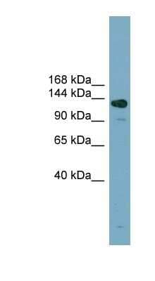 Western Blot: ASXL2 Antibody [NBP1-56576]