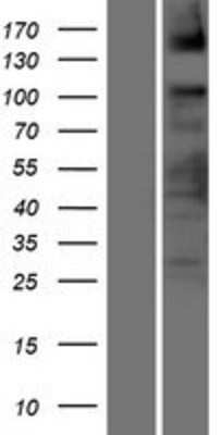 Western Blot: ASXL2 Overexpression Lysate [NBP2-06830]