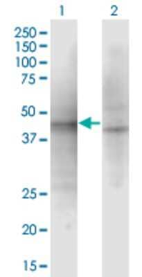 Western Blot: ASZ1 Antibody (3C9) [H00136991-M01]