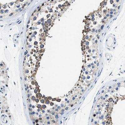 ASZ1 Antibody - BSA Free (NBP1-89130) by Novus, Part of Bio-Techne