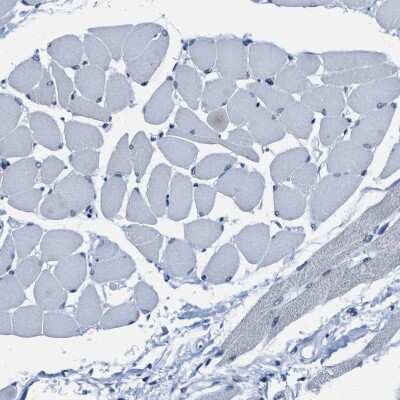 Immunohistochemistry-Paraffin: ASZ1 Antibody [NBP1-89130]