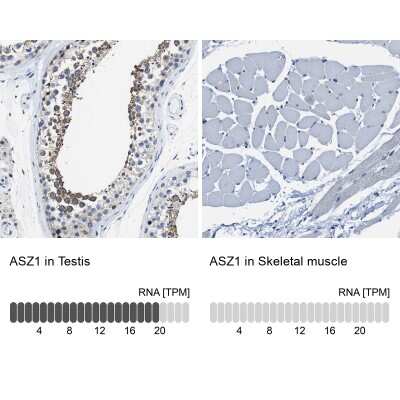 Immunohistochemistry-Paraffin: ASZ1 Antibody [NBP1-89130]