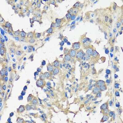 Immunohistochemistry-Paraffin: ASZ1 Antibody - Azide and BSA Free [NBP2-92863]