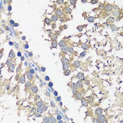 Immunohistochemistry-Paraffin: ASZ1 Antibody - Azide and BSA Free [NBP2-92863]