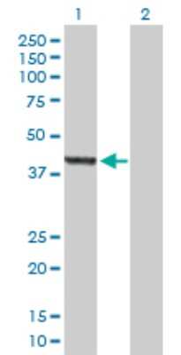 Western Blot: ASZ1 Antibody [H00136991-B01P]