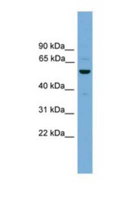 Western Blot: ASZ1 Antibody [NBP1-57071]