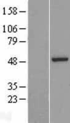 Western Blot: ASZ1 Overexpression Lysate [NBP2-05731]