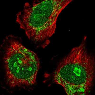 Immunocytochemistry/ Immunofluorescence: ATAD1 Antibody [NBP1-82228]