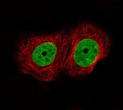Immunocytochemistry/ Immunofluorescence: ATAD2 Antibody (CL0182) [NBP2-14786]