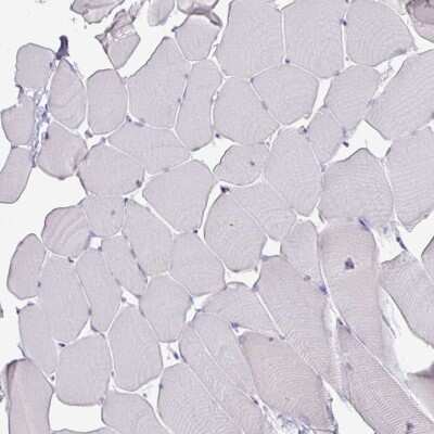 Immunohistochemistry-Paraffin: ATAD2 Antibody (CL0182) [NBP2-14786]